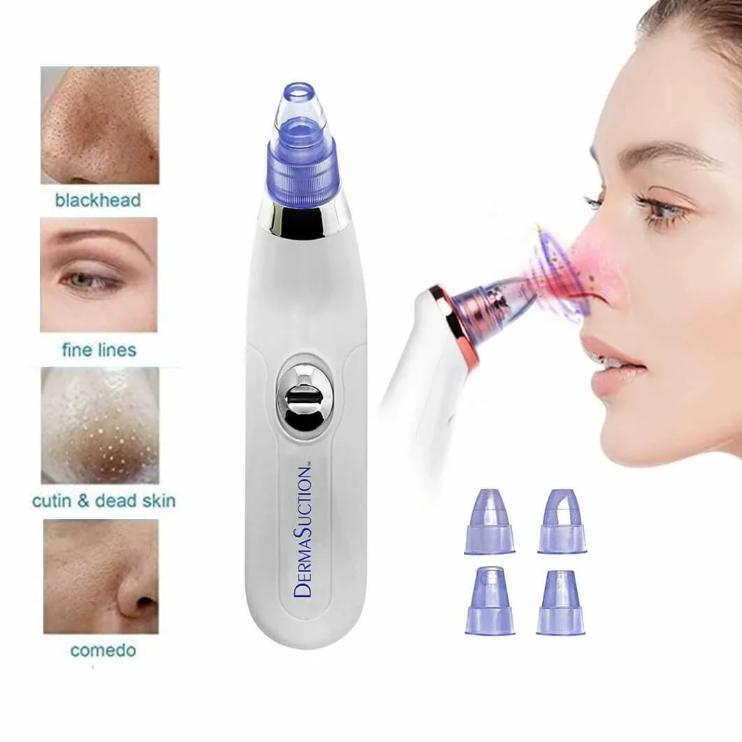 4-in-1 Vacuum Derma Suction Pore Cleaner – Blackhead Remover & Facial Skin Care Device