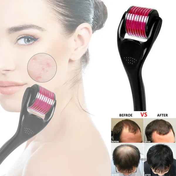 (High Quality) Derma Roller 0.5mm – Skin Therapy Micro-Needle 540 for Acne Scars, Wrinkles, Stretch Marks & Pores